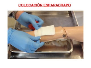 COLOCACIÓN ESPARADRAPO
 
