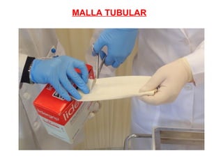 MALLA TUBULAR
 