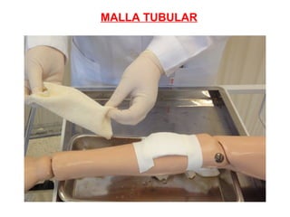 MALLA TUBULAR
 