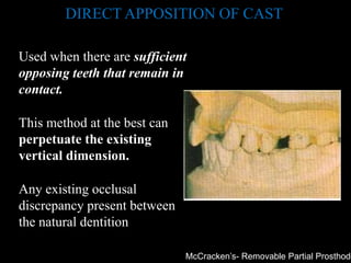 Partial Apposition 3.jaw relation and occ in rpd | PPTX