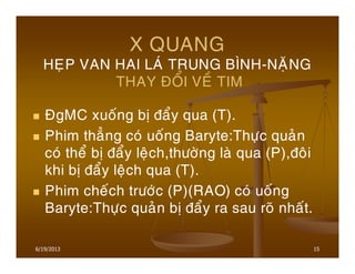 15
X QUANG
HEÏP VAN HAI LAÙ TRUNG BÌNH-NAËNG
THAY ÑOÅI VEÀ TIM
ÑgMC xuoáng bò ñaåy qua (T).
Phim thaúng coù uoáng Baryte:Thöïc quaûn
coù theå bò ñaåy leäch,thöôøng laø qua (P),ñoâi
khi bò ñaåy leäch qua (T).
Phim cheách tröôùc (P)(RAO) coù uoáng
Baryte:Thöïc quaûn bò ñaåy ra sau roõ nhaát.
6/19/2013
 