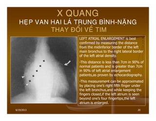 20
X QUANG
HEÏP VAN HAI LAÙ TRUNG BÌNH-NAËNG
THAY ÑOÅI VEÀ TIM
LEFT ATRIAL ENLARGEMENT is best
confirmed by measuring the distance
from the midinferior border of the left
main bronchus to the right lateral border
of the left atrial density.
-This distance is less than 7cm in 90% of
normal patients and is greater than 7cm
in 90% of left atrial enlargement
patients,as proven by echocardiography.
-This measurement can be approximated
by placing one’s right fifth finger under
the left bronchus,and while keeping the
fingers closed,if the left atrium is seen
beyond one’s four fingertips,the left
atrium is enlarged.
6/19/2013
 