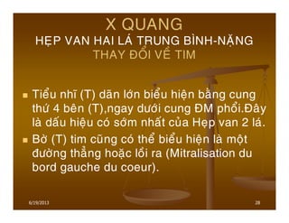 28
X QUANG
HEÏP VAN HAI LAÙ TRUNG BÌNH-NAËNG
THAY ÑOÅI VEÀ TIM
Tieåu nhó (T) daõn lôùn bieåu hieän baèng cung
thöù 4 beân (T),ngay döôùi cung ÑM phoåi.Ñaây
laø daáu hieäu coù sôùm nhaát cuûa Heïp van 2 laù.
Bôø (T) tim cuõng coù theå bieåu hieän laø moät
ñöôøng thaúng hoaëc loài ra (Mitralisation du
bord gauche du coeur).
6/19/2013
 