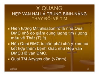 29
X QUANG
HEÏP VAN HAI LAÙ TRUNG BÌNH-NAËNG
THAY ÑOÅI VEÀ TIM
Hieän töôïng Mitralisation roõ laø nhôø Quai
ÑMC nhoû do giaûm cung löôïng tim (löôïng
maùu veà Thaát (T) ít).
Neáu Quai ÑMC to,caàn phaûi chuù yù xem coù
keát hôïp theâm beänh khaùc nhö Heïp van
ÑMC,Hôû van ÑMC.
Quai TM Azygos daõn (>7mm).
6/19/2013
 