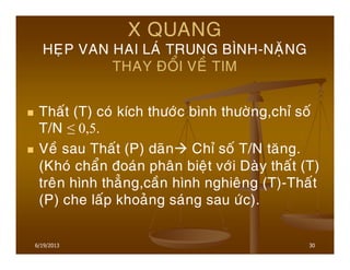 30
X QUANG
HEÏP VAN HAI LAÙ TRUNG BÌNH-NAËNG
THAY ÑOÅI VEÀ TIM
Thaát (T) coù kích thöôùc bình thöôøng,chæ soá
T/N ≤ 0,5.
Veà sau Thaát (P) daõn Chæ soá T/N taêng.
(Khoù chaån ñoaùn phaân bieät vôùi Daøy thaát (T)
treân hình thaúng,caàn hình nghieâng (T)-Thaát
(P) che laáp khoaûng saùng sau öùc).
6/19/2013
 