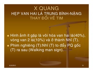 6/19/2013 31
X QUANG
HEÏP VAN HAI LAÙ TRUNG BÌNH-NAËNG
THAY ÑOÅI VEÀ TIM
Hình aûnh ít gaëp laø voâi hoùa van hai laù(40%),
voøng van 2 laù(10%) vaø ôû thaønh Nhó (T).
Phim nghieâng (T):Nhó (T) to ñaåy PQ goác
(T) ra sau (Walking man sign).
 