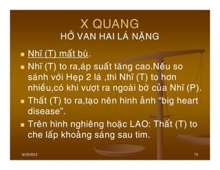 6/19/2013 73
X QUANG
HÔÛ VAN HAI LAÙ NAËNG
Nhó (T) maát buø.
Nhó (T) to ra,aùp suaát taêng cao.Neáu so
saùnh vôùi Heïp 2 laù ,thì Nhó (T) to hôn
nhieàu,coù khi vöôït ra ngoaøi bôø cuûa Nhó (P).
Thaát (T) to ra,taïo neân hình aûnh “big heart
disease”.
Treân hình nghieâng hoaëc LAO: Thaát (T) to
che laáp khoaûng saùng sau tim.
 