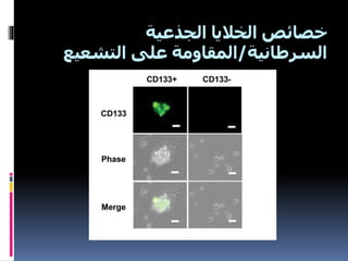 ‫الجذعية‬ ‫الخاليا‬ ‫خصائص‬
‫السرطانية‬/‫على‬ ‫المقاومة‬‫التشعي‬‫ع‬
 