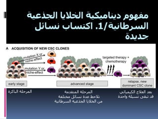 ‫الجذع‬ ‫الخاليا‬ ‫ديناميكية‬ ‫مفهوم‬‫ية‬
‫السرطانية‬/1.‫نسائل‬ ‫اكتساب‬
‫جديدة‬
‫الباكرة‬ ‫المرحلة‬ ‫المتقدمة‬ ‫المرحلة‬
‫مختلفة‬ ‫نسائل‬ ‫عدة‬ ‫نالحظ‬
‫السرطانية‬ ‫الجذعية‬ ‫الخاليا‬ ‫من‬
‫الكيميائي‬ ‫العالج‬ ‫بعد‬
‫واحدة‬ ‫نسيلة‬ ‫تبقى‬ ‫قد‬
 
