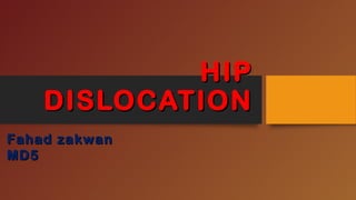 HIPHIP
DISLOCATIONDISLOCATION
Fahad zakwanFahad zakwan
MD5MD5
 