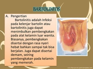 BARTOLINITIS
A. Pengertian
Bartolinitis adalah Infeksi
pada kelenjar bartolin atau
bartolinitis juga dapat
menimbulkan pembengkakan
pada alat kelamin luar wanita.
Biasanya, pembengkakan
disertai dengan rasa nyeri
hebat bahkan sampai tak bisa
berjalan. Juga dapat disertai
demam, seiring
pembengkakan pada kelamin
yang memerah.
 