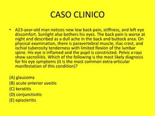 CASO CLINICO
• A23-year-old man notices new low back pain, stiffness, and left eye
discomfort. Sunlight also bothers his eyes. The back pain is worse at
night and described as a dull ache in the back and buttock area. On
physical examination, there is paravertebral muscle, iliac crest, and
ischial tuberosity tenderness with limited flexion of the lumbar
spine. His eye is inflamed and the pupil is constricted. Pelvic x-rays
show sacroiliitis. Which of the following is the most likely diagnosis
for his eye symptoms (it is the most common extra-articular
manifestation of this condition)?
(A) glaucoma
(B) acute anterior uveitis
(C) keratitis
(D) conjunctivitis
(E) episcleritis
 