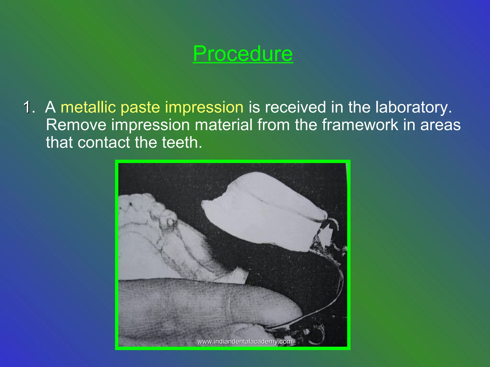 Procedure
11. A metallic paste impression is received in the laboratory.
Remove impression material from the framework in areas
that contact the teeth.
www.indiandentalacademy.comwww.indiandentalacademy.com
 