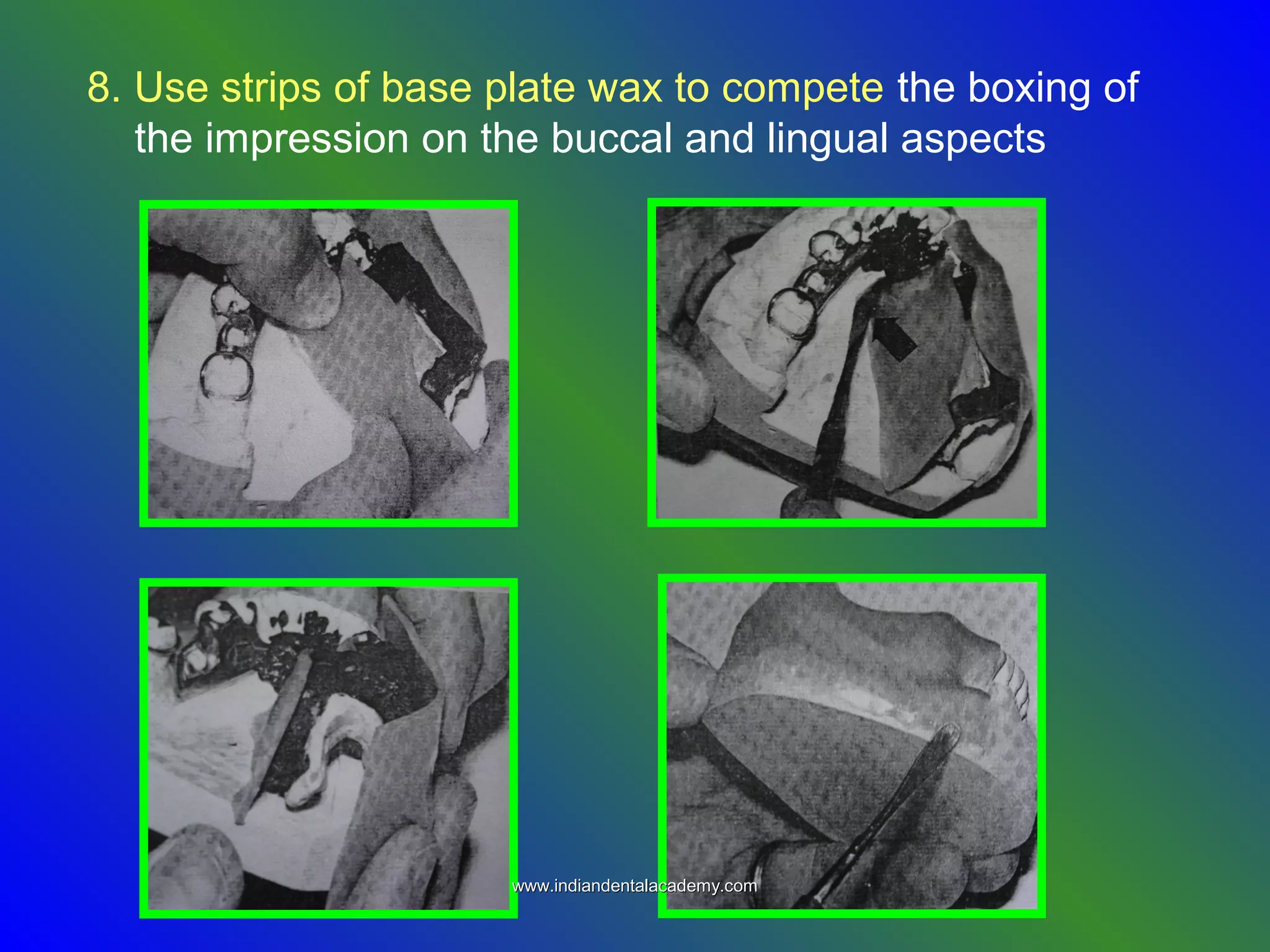 8. Use strips of base plate wax to compete the boxing of
the impression on the buccal and lingual aspects
www.indiandentalacademy.comwww.indiandentalacademy.com
 