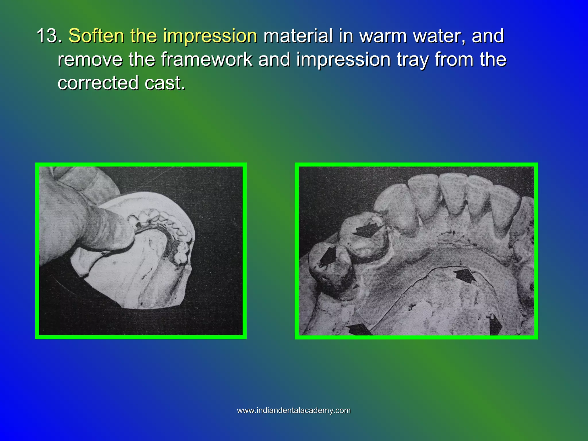 13.13. Soften the impressionSoften the impression material in warm water, andmaterial in warm water, and
remove the framework and impression tray from theremove the framework and impression tray from the
corrected cast.corrected cast.
www.indiandentalacademy.comwww.indiandentalacademy.com
 