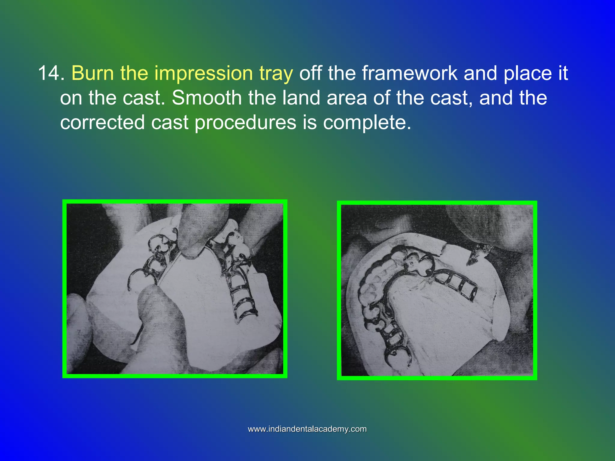 14. Burn the impression tray off the framework and place it
on the cast. Smooth the land area of the cast, and the
corrected cast procedures is complete.
www.indiandentalacademy.comwww.indiandentalacademy.com
 