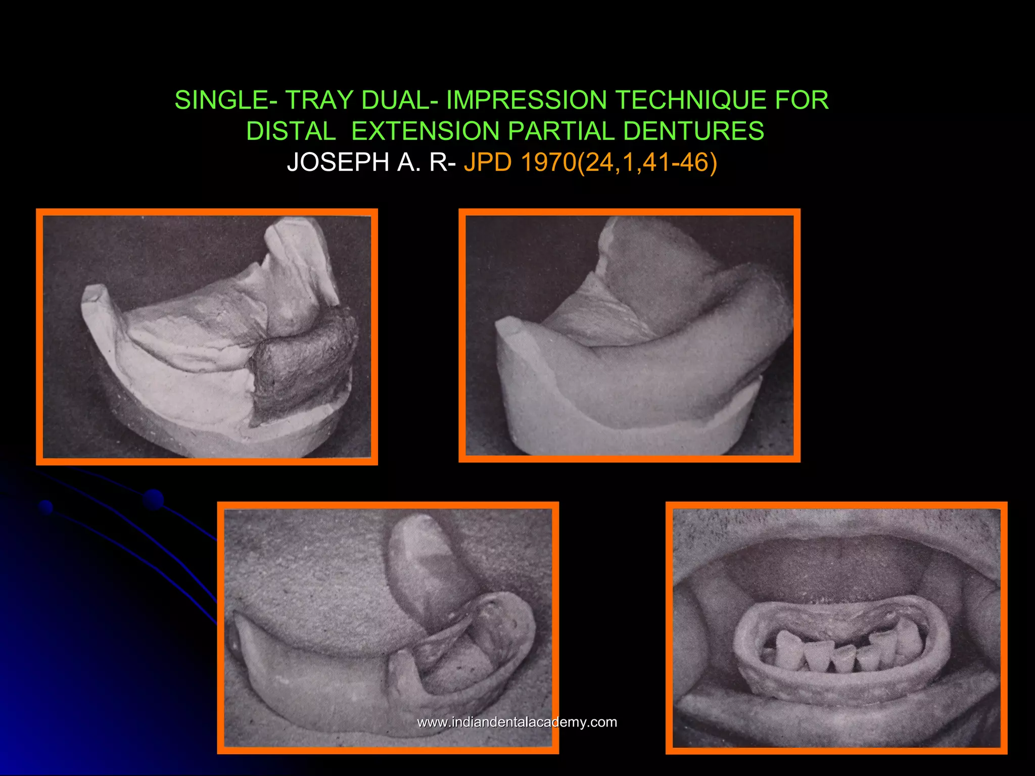 SINGLE- TRAY DUAL- IMPRESSION TECHNIQUE FOR
DISTAL EXTENSION PARTIAL DENTURES
JOSEPH A. R- JPD 1970(24,1,41-46)
www.indiandentalacademy.comwww.indiandentalacademy.com
 