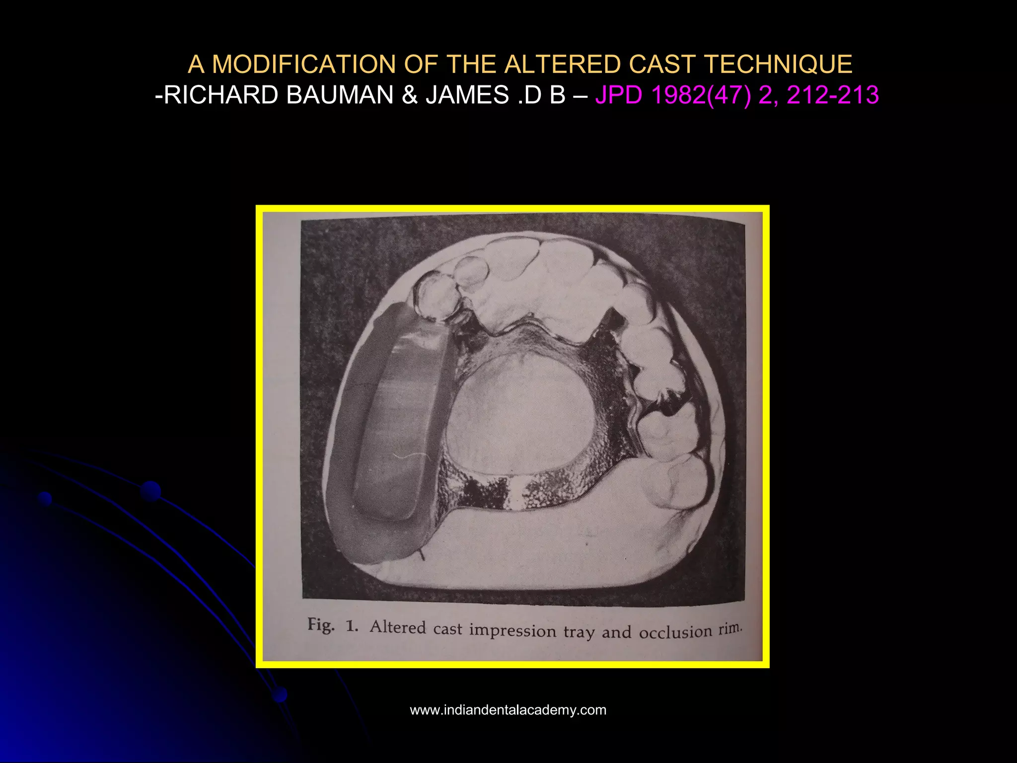 A MODIFICATION OF THE ALTERED CAST TECHNIQUE
-RICHARD BAUMAN & JAMES .D B – JPD 1982(47) 2, 212-213
www.indiandentalacademy.comwww.indiandentalacademy.com
 