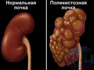 Ока мочи это
