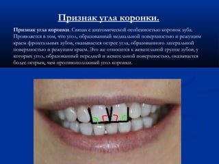 Признак угла коронки. 
Признак угла коронки. Связан с анатомической особенностью коронок зуба. 
Проявляется в том, что угол, образованный медиальной поверхностью и режущим 
краем фронтальных зубов, оказывается острее угла, образованного латеральной 
поверхностью и режущим краем. Это же относится к жевательной группе зубов, у 
которых угол, образованный передней и жевательной поверхностью, оказывается 
более острым, чем противоположный угол коронки. 
 