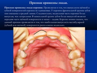 Признак кривизны эмали. 
Признак кривизны эмали коронки. Проявляется в том, что выпуклости щёчной и 
губной поверхностей коронок не одинаковые. У коронок фронтальной группы зубов 
они смещены к средней линии. Следовательно, медиальная часть коронки более 
выпуклая, чем латеральная. В жевательной группе зубов более выпуклой является 
передняя часть щёчной поверхности и менее – задняя. Коротко можно сказать, что 
данный признак проявляется в том, что наибольшая выпуклость вестибулярной 
(губной или щечной) поверхности расположена медиально. 
 