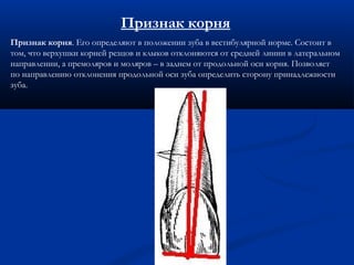Признак корня 
Признак корня. Его определяют в положении зуба в вестибулярной норме. Состоит в 
том, что верхушки корней резцов и клыков отклоняются от средней линии в латеральном 
направлении, а премоляров и моляров – в заднем от продольной оси корня. Позволяет 
по направлению отклонения продольной оси зуба определить сторону принадлежности 
зуба. 
 
