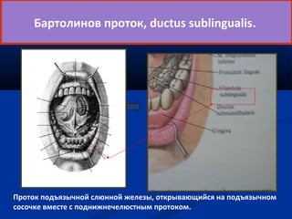 Бартолинов проток, ductus sublingualis. 
Проток подъязычной слюнной железы, открывающийся на подъязычном 
сосочке вместе с поднижнечелюстным протоком. 
 