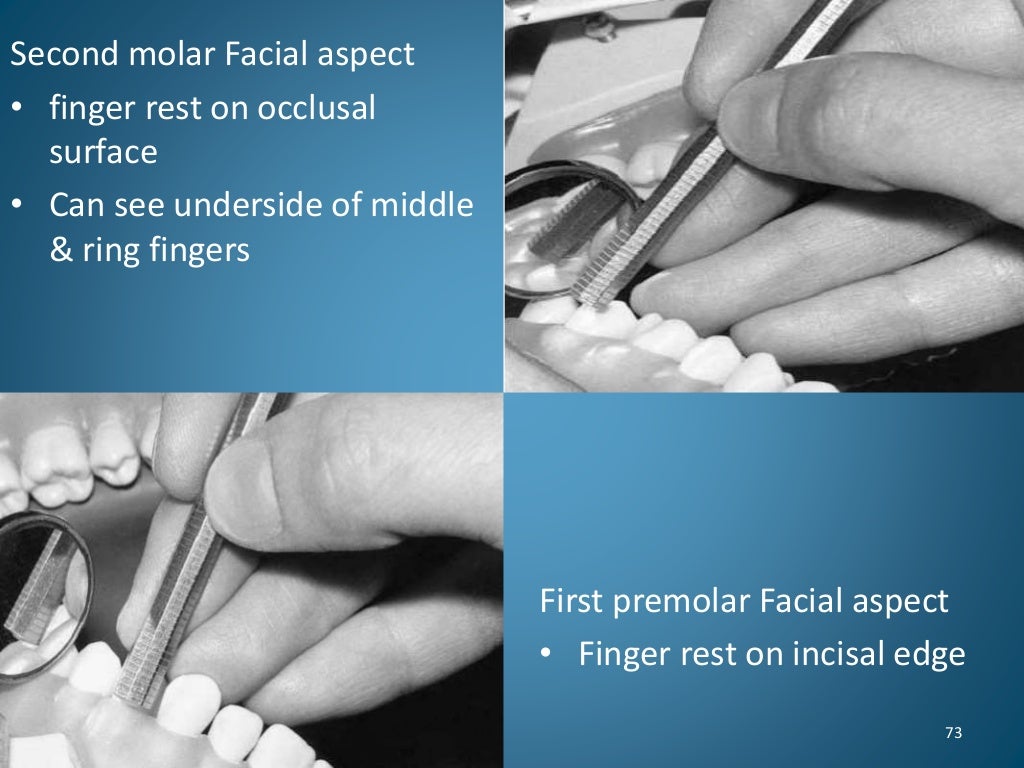 Periodontics Mirror and Finger rests