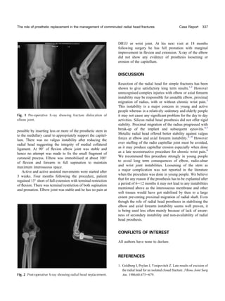 The role of prosthetic replacement in the management of comminuted ...