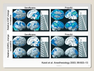 Kaisti et al. Anesthesiology 2003; 99:603–13 
10/30/14 13 
 