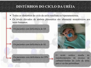DISTÚRBIOS DO CICLO DA URÉIA 
 Todos os distúrbios do ciclo da uréia resultam na hiperamonemia. 
 Os níveis elevados de amônia plasmática são altamente neurotóxicos aos 
seres humanos. 
Os pacientes com deficiência de AS 
Os pacientes com deficiência de AL 
Os pacientes com deficiência de CPS 
ou OTC 
O ácido orótico resulta do 
transbordamento do excesso de 
carbamil-fosfato do ciclo da uréia 
para a via das pirimidinas. 
 
