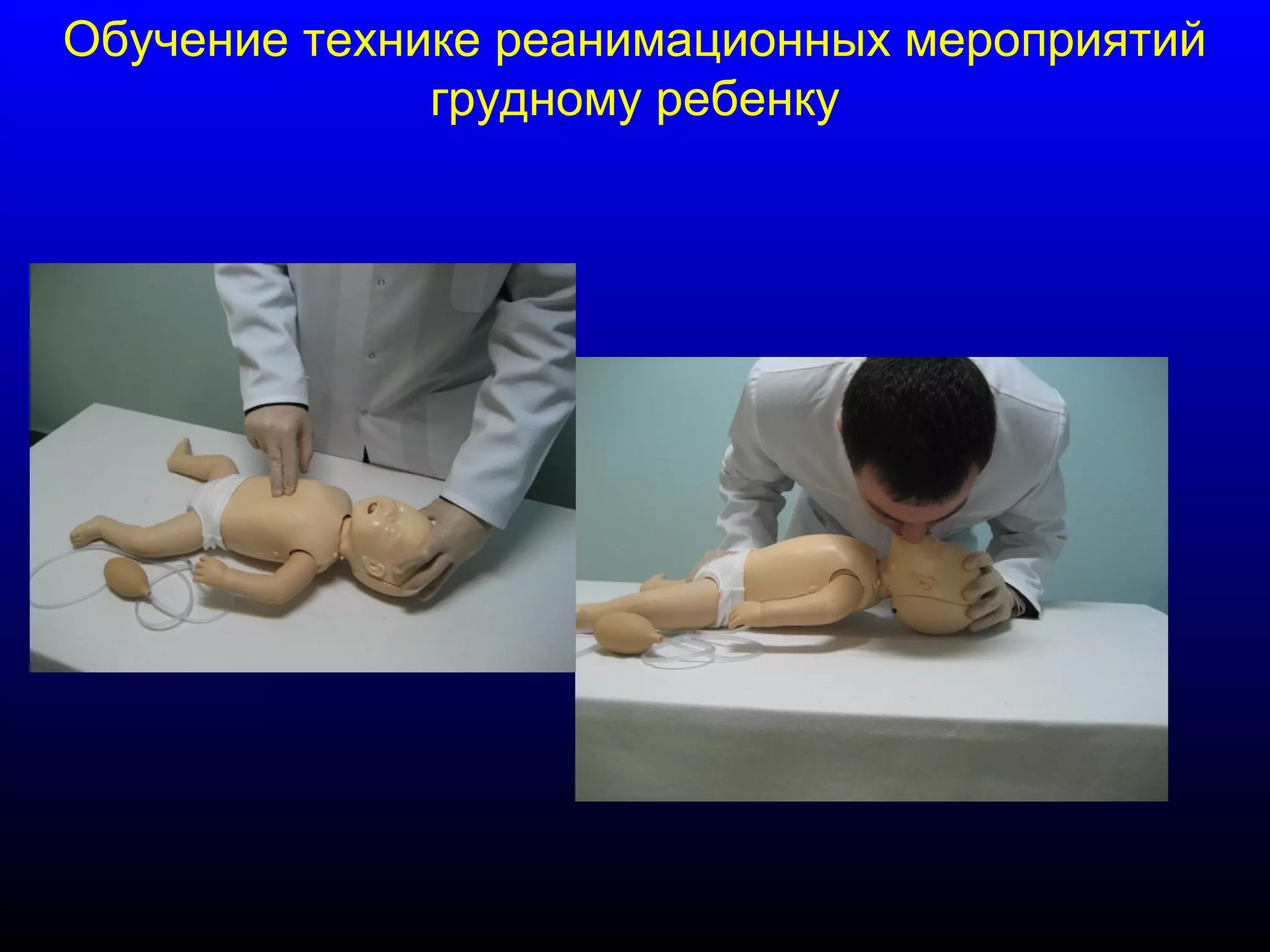 Обучение технике реанимационных мероприятий 
грудному ребенку 
 