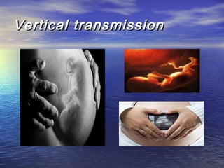 Vertical transmissionVertical transmission
 