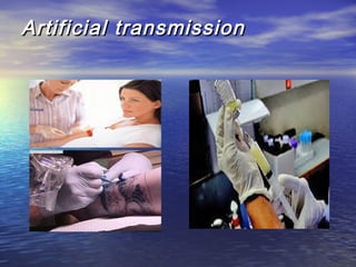 Artificial transmissionArtificial transmission
 