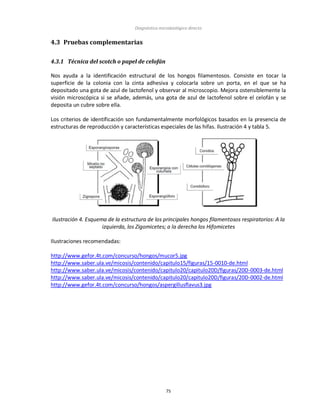 Diagnóstico microbiológico directo
75
4.3 Pruebas complementarias
4.3.1 Técnica del scotch o papel de celofán
Nos ayuda a la identificación estructural de los hongos filamentosos. Consiste en tocar la
superficie de la colonia con la cinta adhesiva y colocarla sobre un porta, en el que se ha
depositado una gota de azul de lactofenol y observar al microscopio. Mejora ostensiblemente la
visión microscópica si se añade, además, una gota de azul de lactofenol sobre el celofán y se
deposita un cubre sobre ella.
Los criterios de identificación son fundamentalmente morfológicos basados en la presencia de
estructuras de reproducción y características especiales de las hifas. Ilustración 4 y tabla 5.
Ilustración 4. Esquema de la estructura de los principales hongos filamentosos respiratorios: A la
izquierda, los Zigomicetes; a la derecha los Hifomicetes
Ilustraciones recomendadas:
http://www.gefor.4t.com/concurso/hongos/mucor5.jpg
http://www.saber.ula.ve/micosis/contenido/capitulo15/figuras/15-0010-de.html
http://www.saber.ula.ve/micosis/contenido/capitulo20/capitulo20D/figuras/20D-0003-de.html
http://www.saber.ula.ve/micosis/contenido/capitulo20/capitulo20D/figuras/20D-0002-de.html
http://www.gefor.4t.com/concurso/hongos/aspergillusflavus3.jpg
 