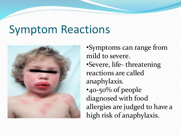 3.food allergens...varun