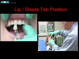Lip / Shade Tab Position
 