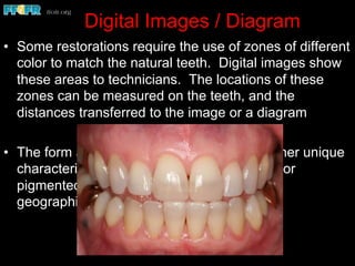 Digital Images / Diagram
•  Some restorations require the use of zones of different
color to match the natural teeth. Digital images show
these areas to technicians. The locations of these
zones can be measured on the teeth, and the
distances transferred to the image or a diagram
•  The form and extent of translucency and other unique
characteristics, such as enamel craze lines or
pigmented areas, are best visualized and
geographically located on digital images
 