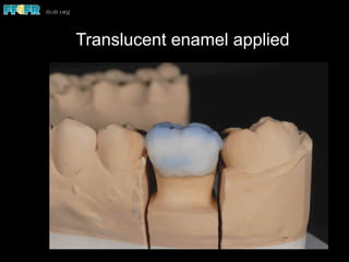 Translucent enamel applied
 