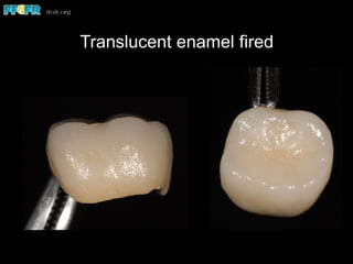 Translucent enamel fired
 