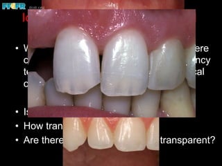 Identification of Translucent and
Transparent Areas
•  Where is the translucency located / Where
on the facial surface does the translucency
terminate (how much of the incisocervical
crown dimension is translucent)?
•  Is the termination abrupt or gradual?
•  How translucent is the area?
•  Are there areas that are nearly transparent?
 