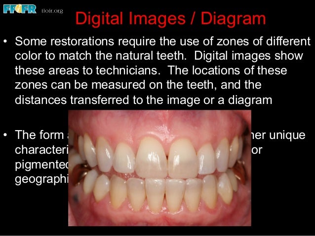 3 color shade selection teeth shading chart
