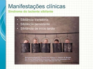Fotógrafa Anne Geddes
Manifestações clínicas
Síndrome do lactente sibilante
• Sibilância transitória
• Sibilância persistente
• Sibilância de início tardio
Martinez FD,Wright AL, Taussig LM, Holberg CJ, Halonen M, Morgan
WJ, Group Health Medical Associates. Asthma and wheezing in the
first six years of life. N Engl J Med 1995;332:133–138
 