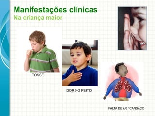 Manifestações clínicas
Na criança maior
TOSSE
DOR NO PEITO
FALTA DE AR / CANSAÇO
 
