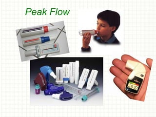 Peak Flow
 