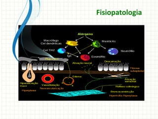 Fisiopatologia
 