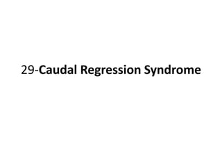29-Caudal Regression Syndrome
 