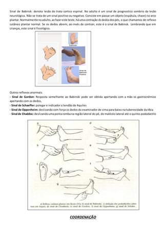 Sinal de Babinsk: denota lesão do trato cortico espinal. No adulto é um sinal de prognostico sombrio da lesão
neurológica. Não se trata de um sinal positivo ou negativo. Consiste em passar um objeto (espátula, chave) no arco
plantar.Normalmente noadulto,aofazereste teste,háumacontração dsdedosdospés, o que chamamos de reflexo
cutâneo plantar normal. Se os dedos abrem, ao invés de contrair, este é o sinal de Babinsk. Lembrando que em
crianças, este sinal é fisiológico.
Outros reflexos anormais:
- Sinal de Gordon: Resposta semelhante ao Babinski pode ser obtida apertando com a mão os gastrocnêmios
apertando com os dedos,
- Sinal de Schaeffer: polegar e indicador o tendão de Aquiles
- Sinal de Oppenheim: deslizando com força os dedos do examinador de cima para baixo na tuberosidade da tíbia
- Sinal de Chaddoc: deslizandoumapontarombana regiãolateral do pé, do maléolo lateral até o quinto pododáctilo
COORDENAÇÃO
 