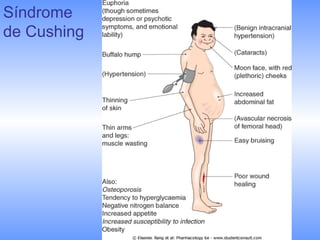 Síndrome
de Cushing
 