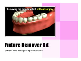 Fixture Remover Kit
Without Bone damage and patient Trauma
 